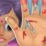 Hand Doctor Egy kéz, amelyen vágások, piros duzzanatok és egy csipesz látható